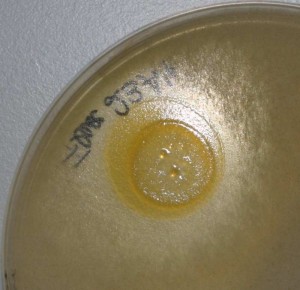 Bakterium Chitinophaga pinensins (gelb)